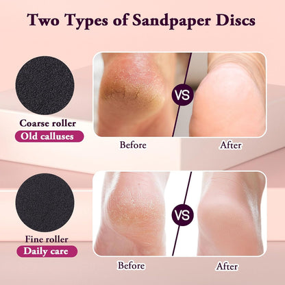 Electric Foot Callus Remover, Adjustable Speed ​​(0-600Rpm), Adjustable Speed Foot Scrubber with 60 Pcs Sandpaper Discs, Electric Callus Remover for Feet,Pedicure Tool for Men and Women,Pink